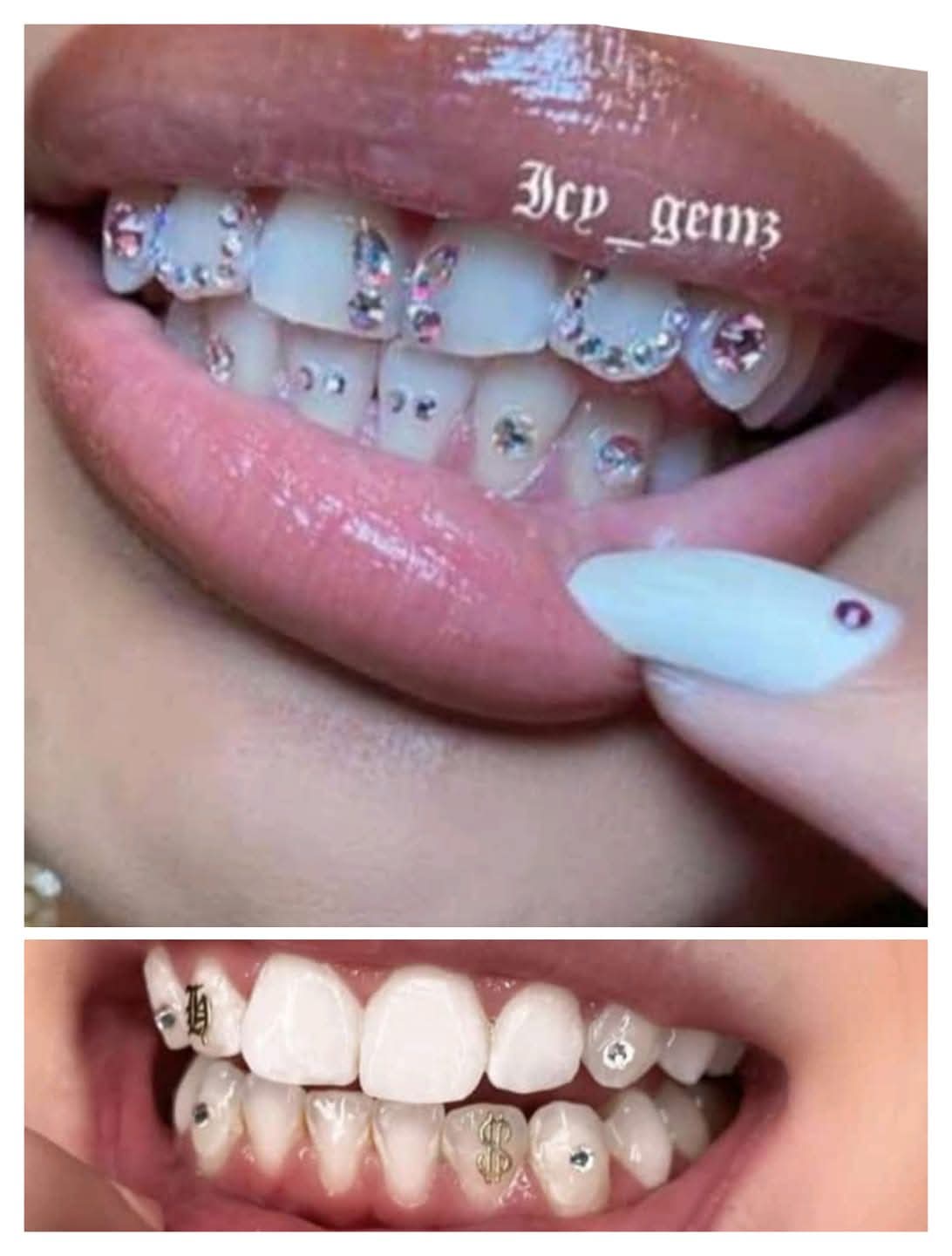 Artificial Teeth 6